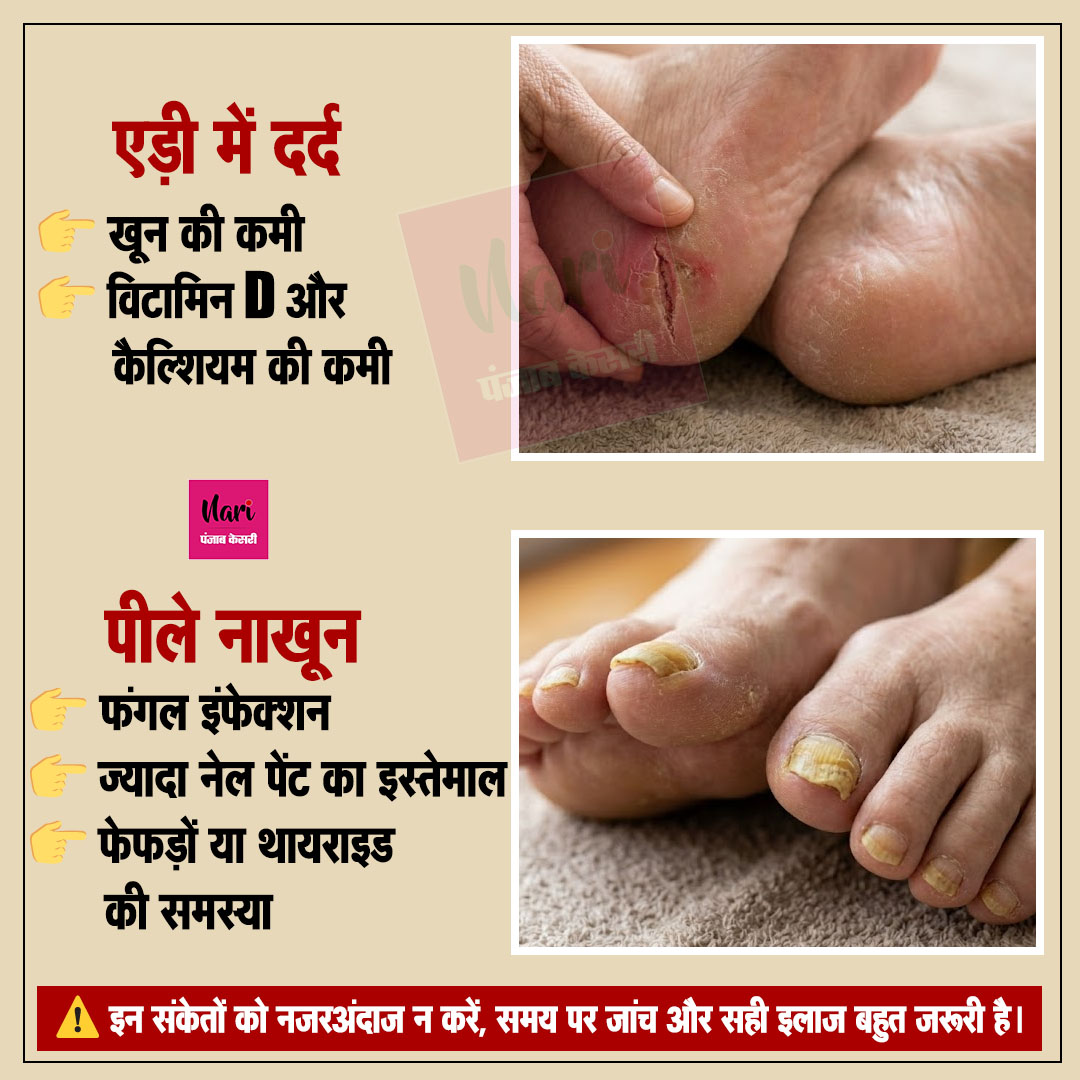 NariKesari's tweet image. 👣 पैरों के लक्षण बताते हैं शरीर की बीमारी – क्या आप पहचानते हैं ये संकेत?

#Health #FootCare #BodySignals #HealthyLife