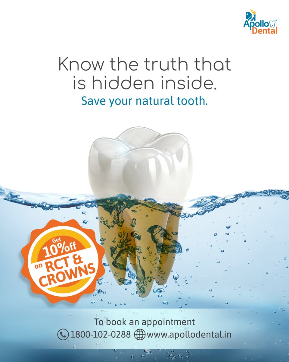 ApolloWhiteDen2's tweet photo. Don't let hidden decay damage your smile.
Save your natural teeth with 10% off RCT and Dental Crowns.

To book your appointment, call 1800-102-0288. https://t.co/dtxOOoLb1l