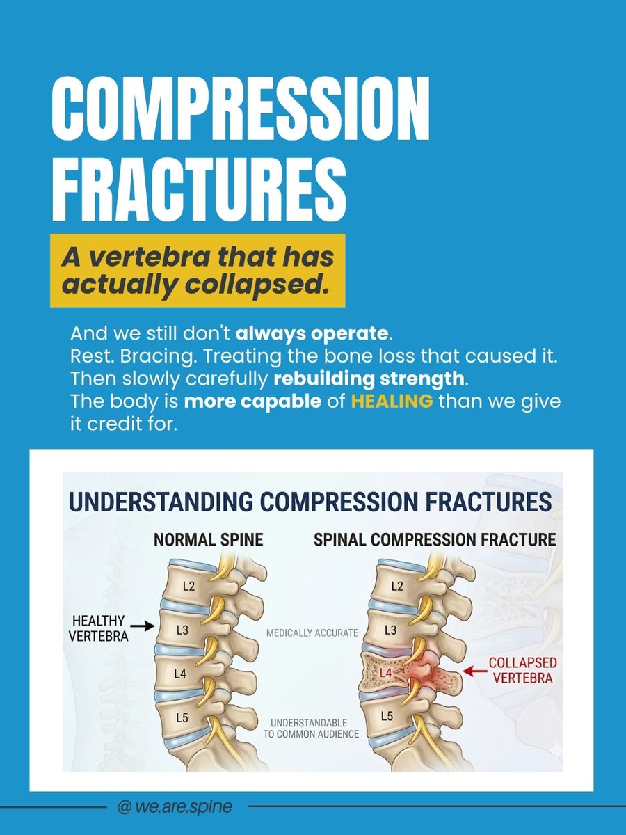 wearespine's tweet photo. She came to us last.
Physio. Right injection. Guided recovery.
No operating room. No stitches. No 6-week wait.
6 weeks later? Back to her life. 
Your spine deserves better than fear.
📲 We Are Spine | 📞 98921 01234
#WeAreSpine #SpineHealth #SurgeryIsNotAlwaysTheAnswer #BackPain https://t.co/xOPALSaF0c