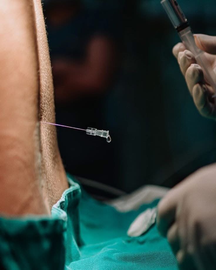 MÃE DE CESÁRIA
Uma sala fria, médicos conversando sobre a vida, acesso, sonda, anestesia.
Ela sente dor por meses e está marcada com uma cicatriz que se chama "MARCA DO AMOR" 
Levanta da cama com muita dificuldade mas isso não impede de cuidar do filho ❤️