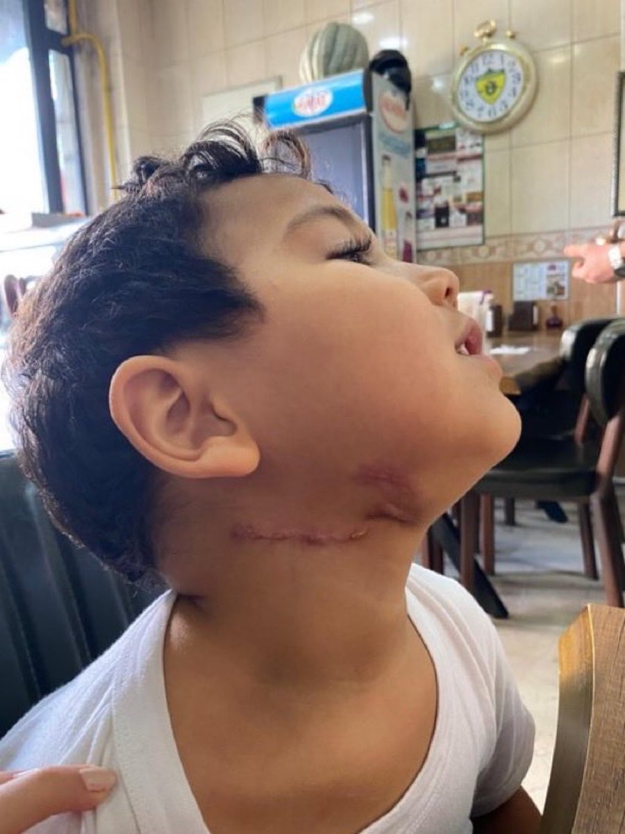 Selman 4 yaşında hasta bir çocuk annesine ihtiyacı var…
Morale, şefkate ihtiyacı var…
Sırf siyasi egolar uğruna bir çocuğu annesinden ayırmak zulümdür!
<a href="/adalet_bakanlik/">T.C. Adalet Bakanlığı</a>