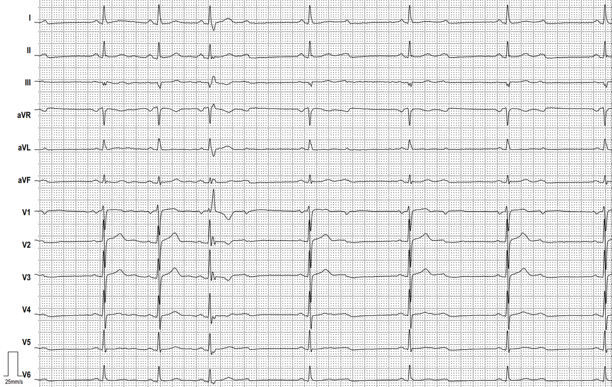Dr. Andreas Roeschl tweet media