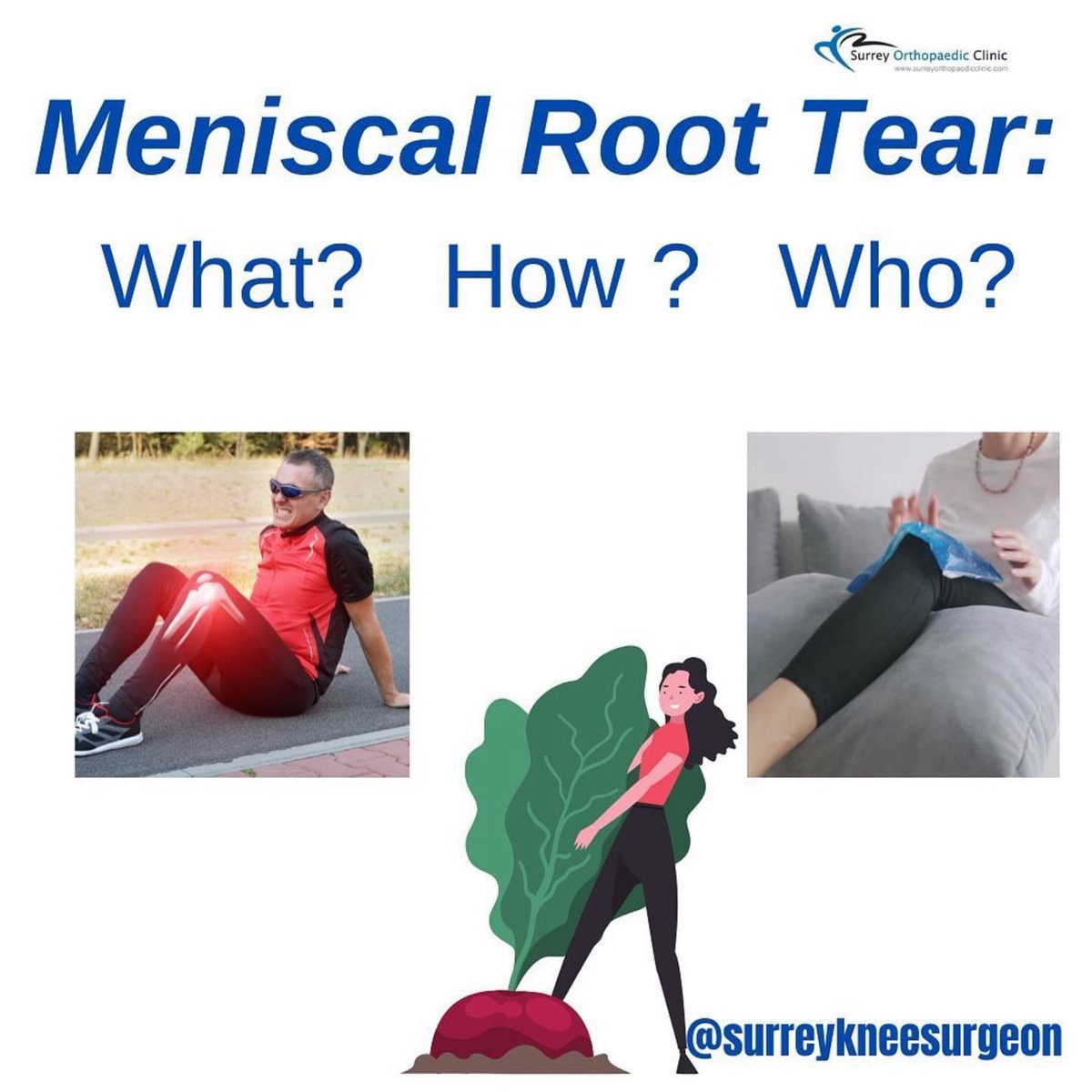 PhysioOsteoGram's tweet photo. What are meniscus roots?

They attach the meniscus to the top of the tibia bone, holding the meniscus in place and provide stability.

❇️ What happens with a root tear? 
 
A complete root tear is equivalent to having the whole meniscus… https://t.co/9lGiEZo57x https://t.co/LlNBYBdAvN