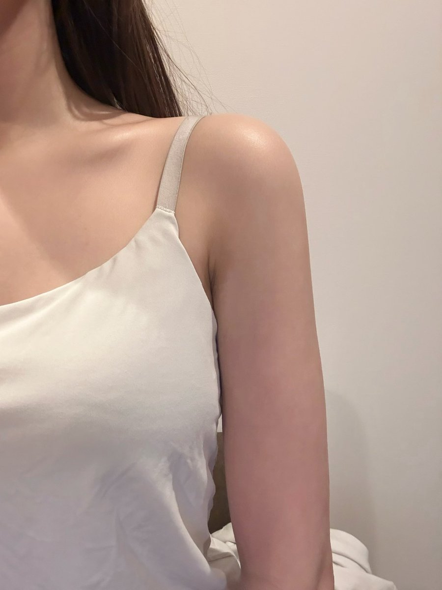 IagUgi's tweet photo. ニュースリムで二の腕脂肪吸引から1ヶ月経過しました🫶
まだ少し硬さや違和感はあるけど、かなりスッキリしてきた気がする！
むくみも落ち着いてきてラインが出てきました～だいぶ細くなって良かった！ https://t.co/k0e4JULaNW