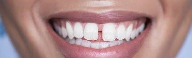 CHIVIDOSKI tweet media