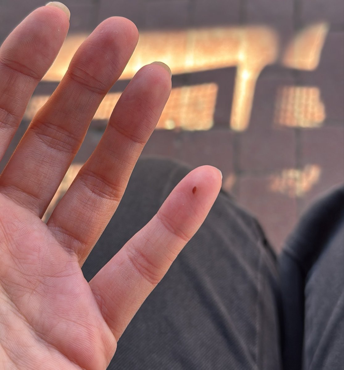 I pinched myself on something a week ago and I’m wondering how long it’s gotta look like I have a seed under my skin 😩😅