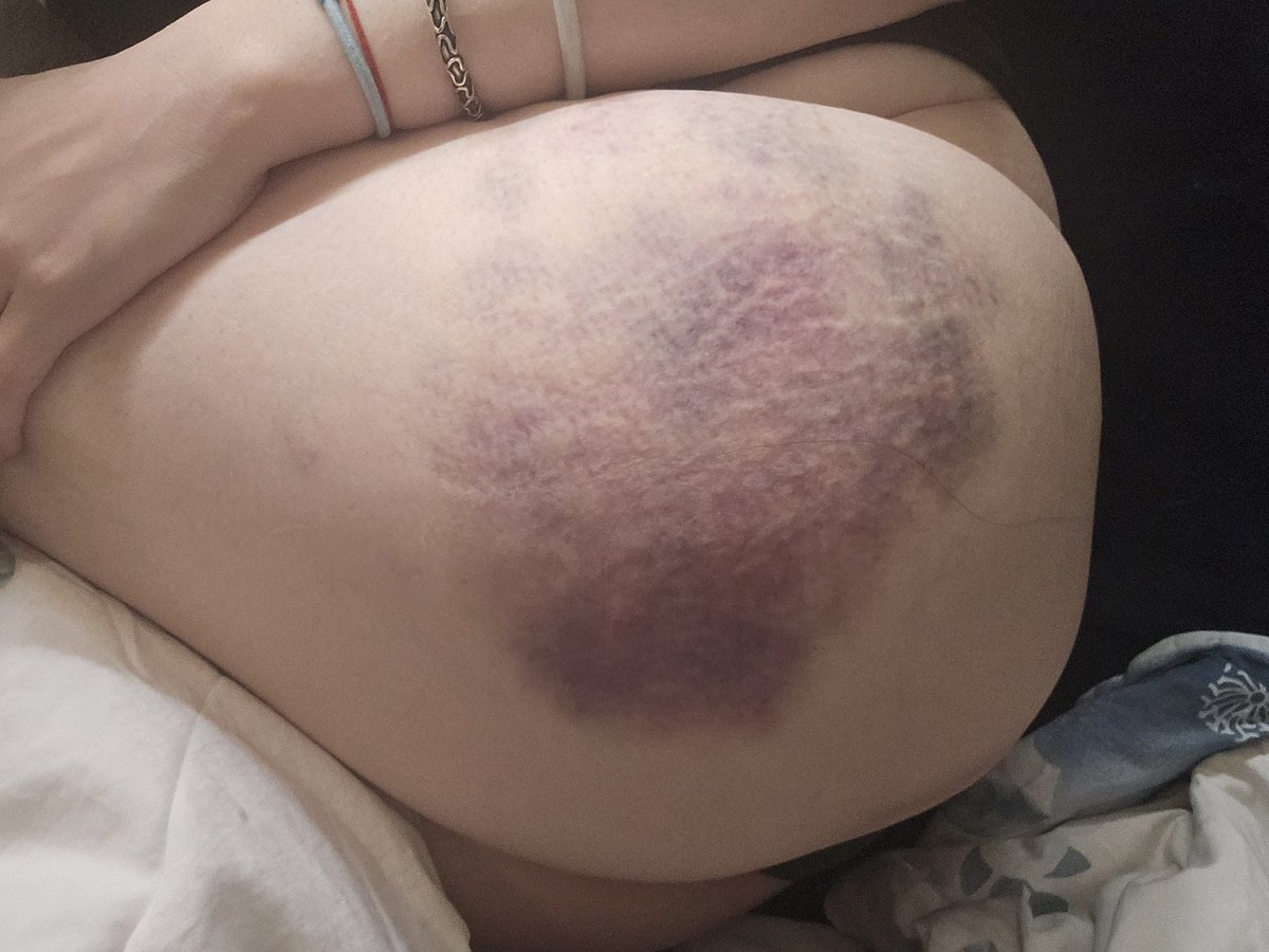 ༺狐妃2.0▪️請叫我大小姐༊*·˚ tweet media