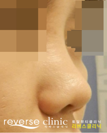 【公式】リバースクリニック | 江南・明洞・弘大 tweet media