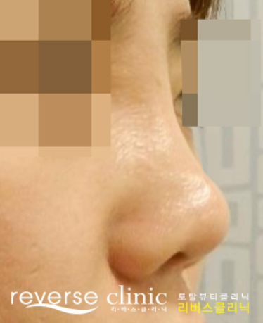 【公式】リバースクリニック | 江南・明洞・弘大 tweet media