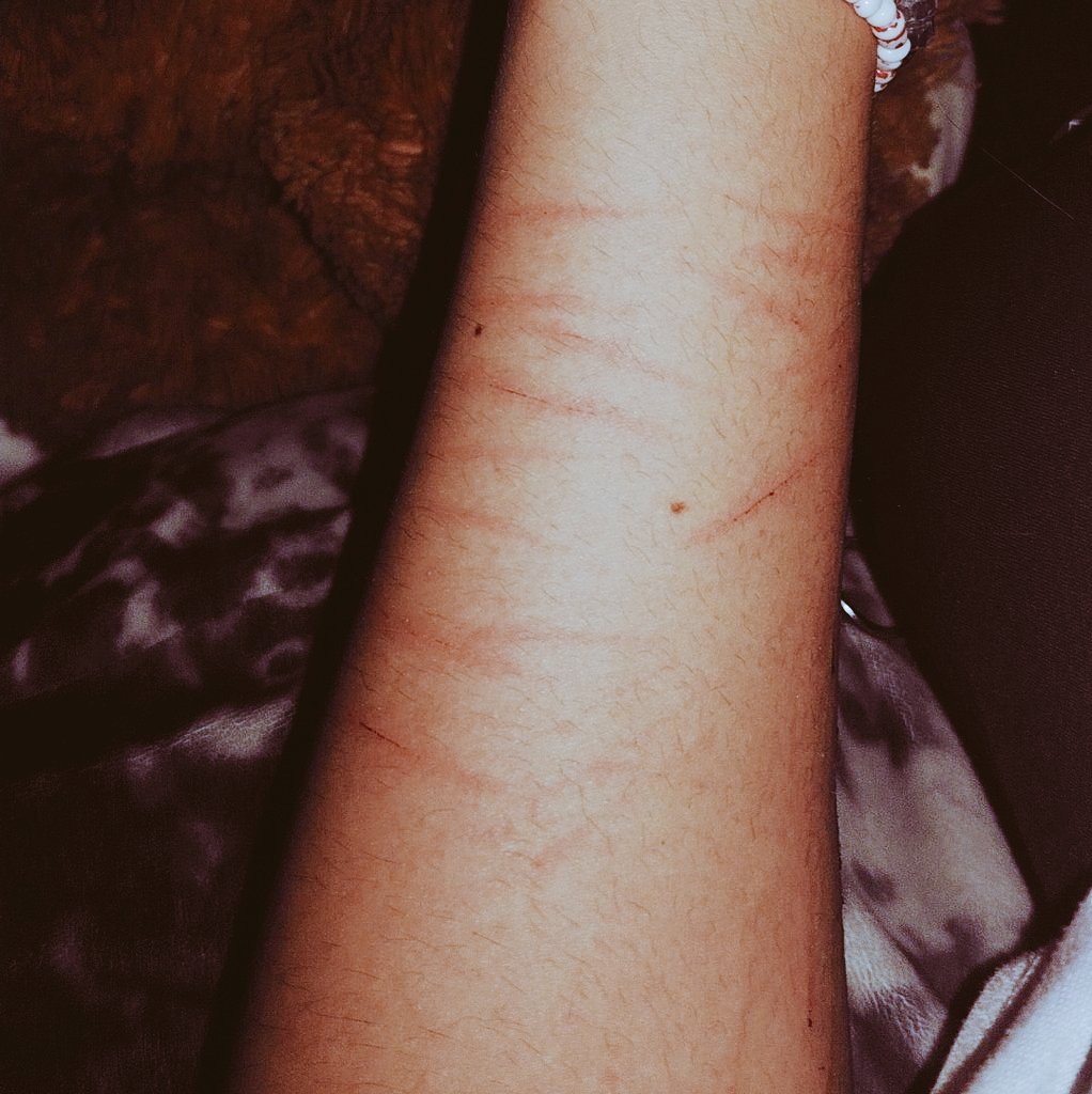 pr5ttydeadd0ll's tweet photo. Necesito una nueva navaja, pero no quedaron tan mal, las de atrás si pq me lastime la otra muñeca y no veía bien.
ಥ⁠‿⁠ಥ
#nsfwtwt #shtwt https://t.co/HVnARwP2Dq