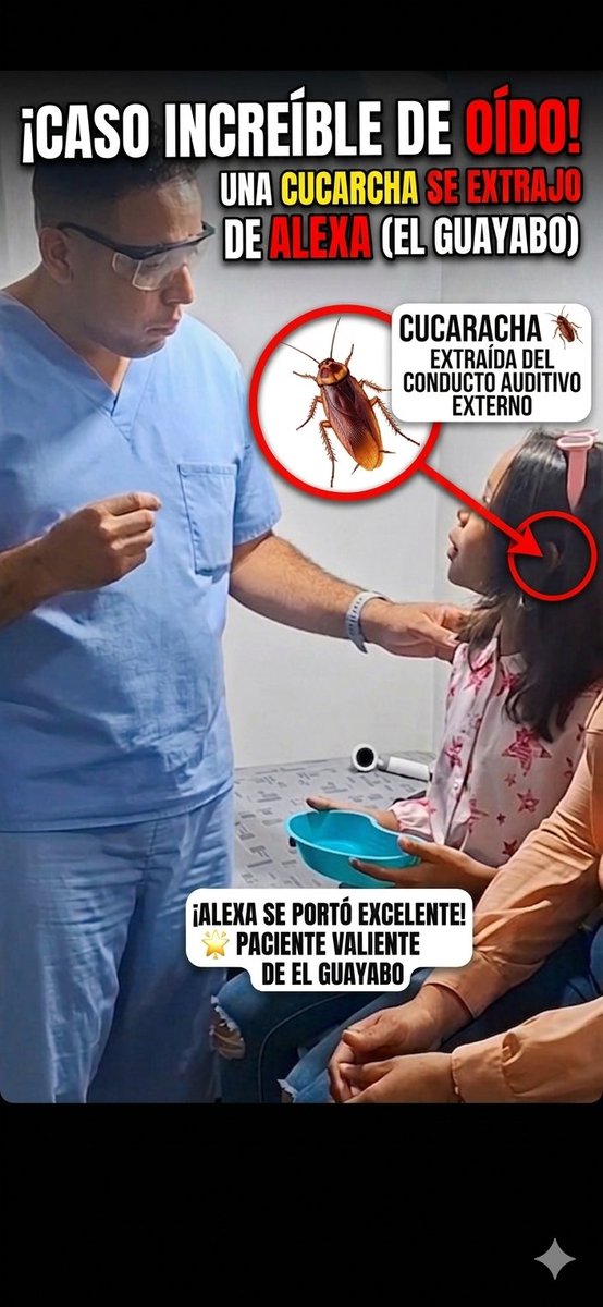KiuverRoca's tweet photo. ¡CUERPOS EXTRAÑOS Y EMERGENCIAS!
​Ayer la consulta fue una verdadera montaña rusa de casos impactantes en el conducto auditivo. Desde extracciones críticas hasta procesos infecciosos severos; aquí les muestro la realidad de lo que vivimos en un día de máxima exigencia clínica. https://t.co/1oFbwNdnDC