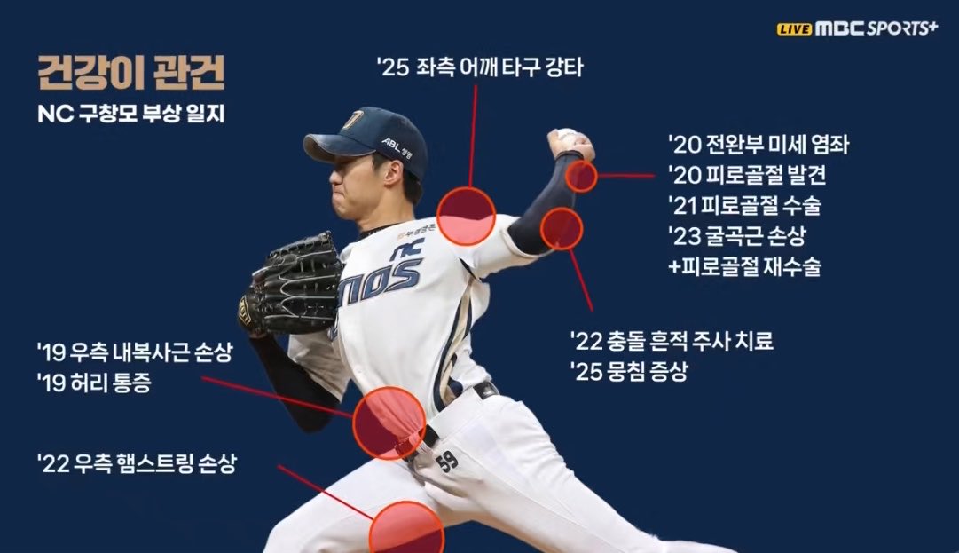 엠스플 진짜 개씨발새끼들인가