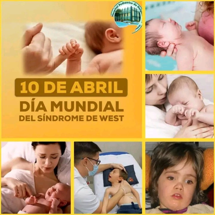 Hoy es el Día Mundial del Síndrome de West, enfermedad rara que aparece entre los 3 y 12 meses de vida, combinando 3 cosas: espasmos alteración del desarrollo y un EEG característico hoy, se trata de visibilizar esta realidad para lograr diagnósticos más rápidos.
#PorLosNiñosTodo
