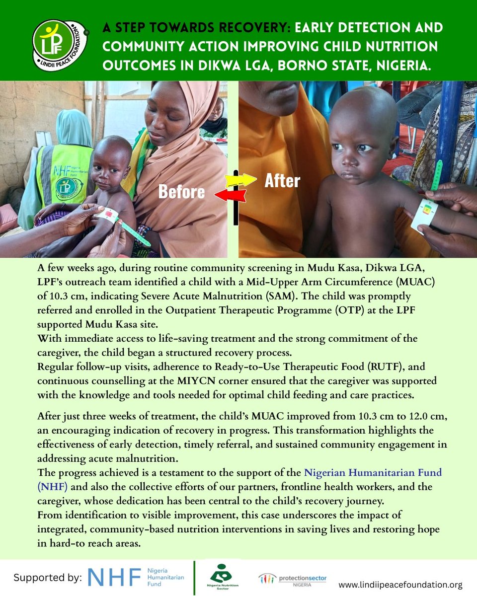 LindiiPeaceFdn's tweet photo. In mudu Kasa, Dikwa LGA, a child identified with SAM (MUAC 10.3 cm) has improved to 12.0 cm after 3 weeks of OTP treatment. 

Through the intervention of @OCHANigeria in the Northeast, NG, #LPF is providing treatment, supporting caregivers, &amp; the community in saving lives. 
#NHF https://t.co/WD4MZmJelu