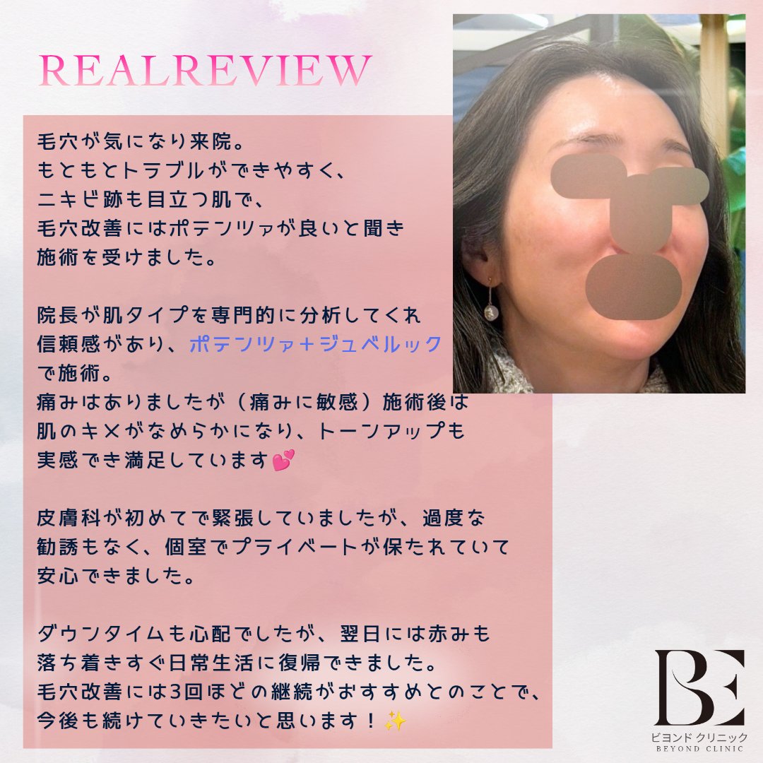 ビヨンド クリニック🤍フィラー・リフティング・アンチエイジング専門🪷 tweet media