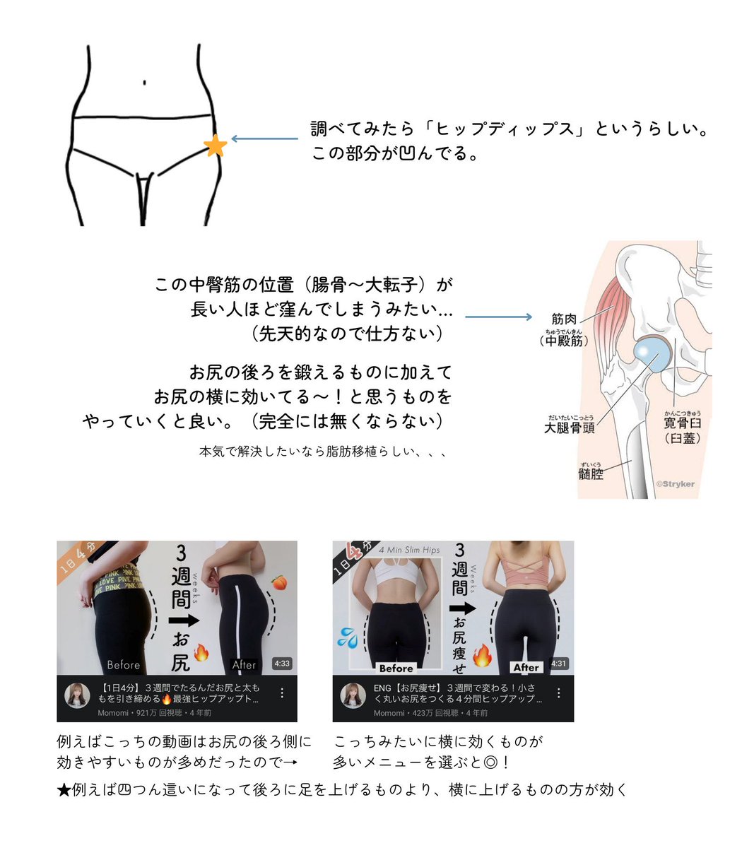 まさに骨ストこういうことなんですよ、、、とにかくお尻の位置を上げる筋トレをするのと二段目の尻を消すためにお尻の横側の筋トレをするのが良いです