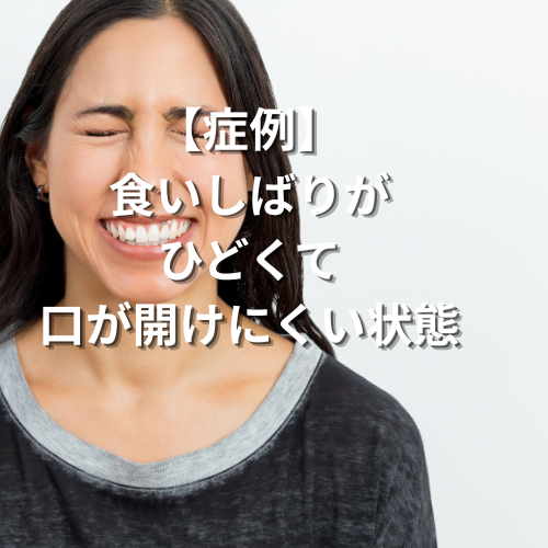 tb_over's tweet photo. 内臓療法講座の参加者が、講座に友人を連れてきてくれました。
実際に施術をして症状が理論通り改善していく過程と、施術後の施術を受けた方の驚きと喜び。
これを体験して欲しくて(^^)

https://t.co/G0BKMlbzQO https://t.co/yik6vFC4W7