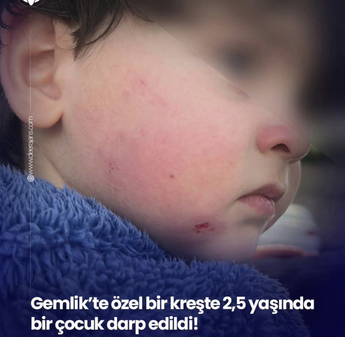 Emre Ercis tweet media