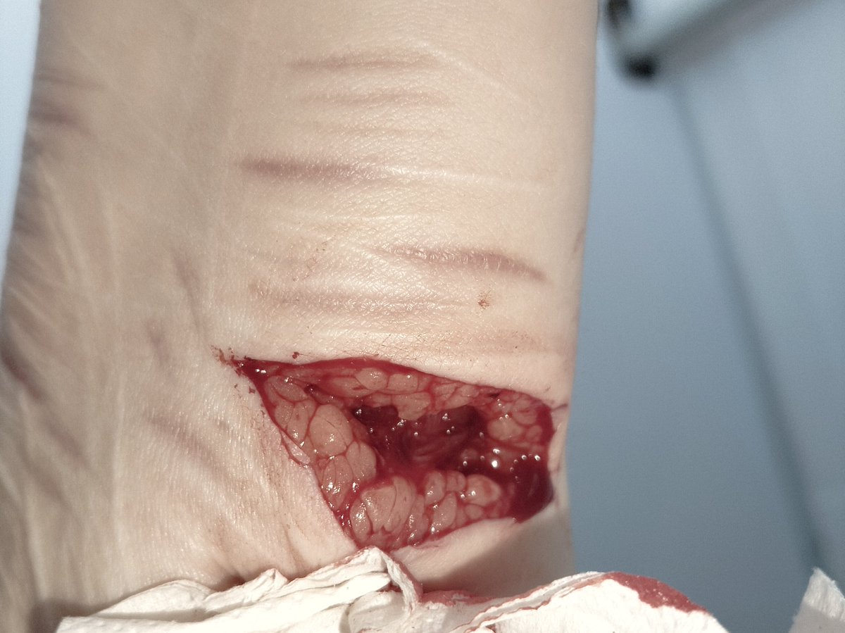 элин tweet media