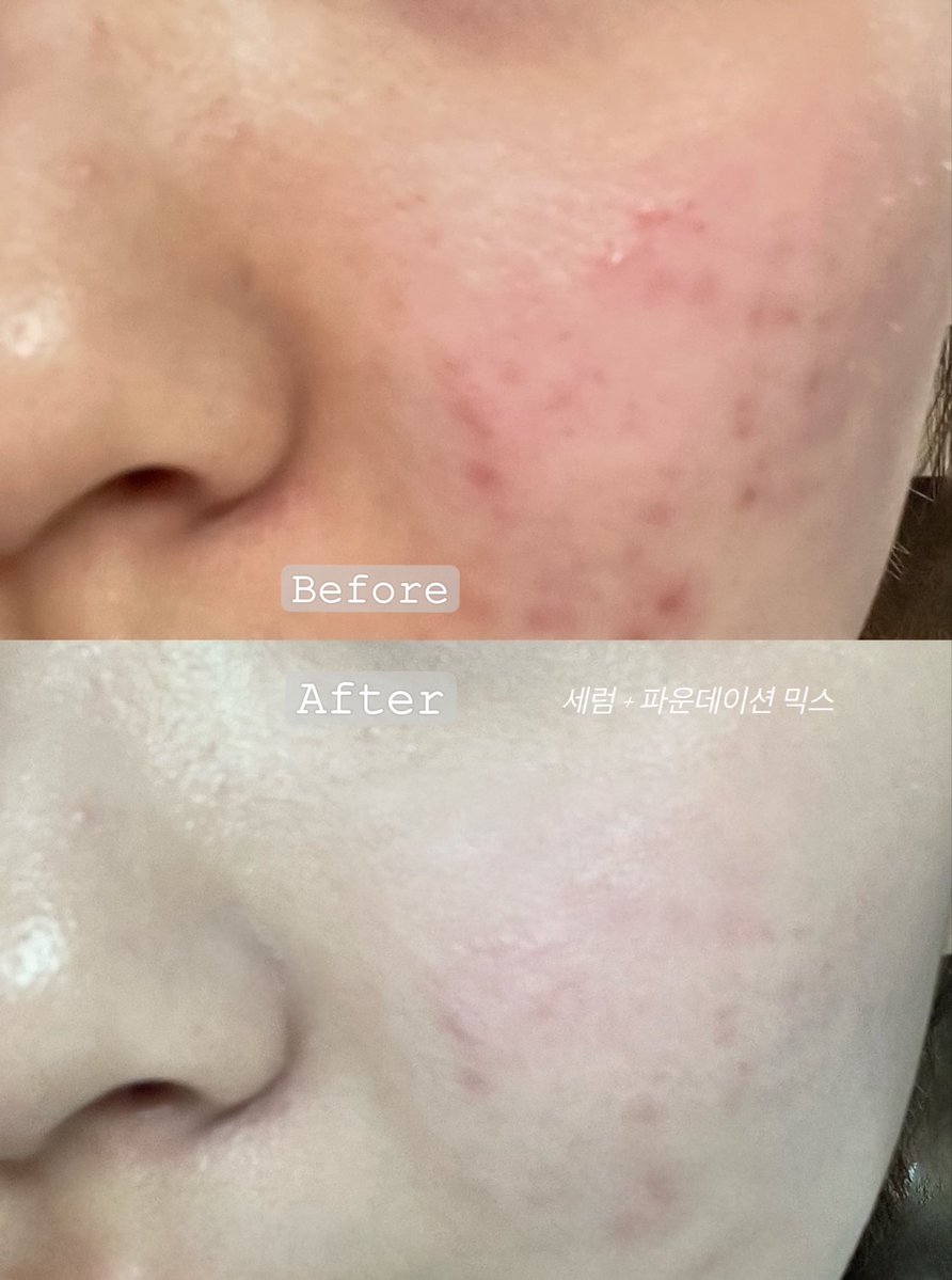 리진🪸 tweet media