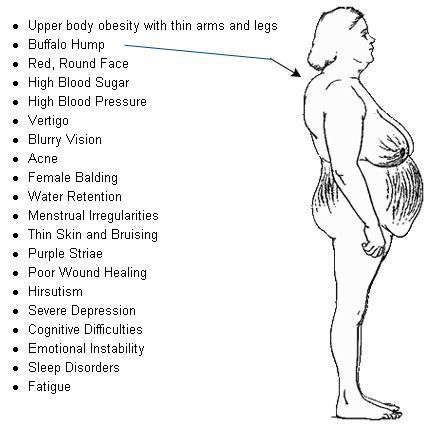 TheAAES's tweet photo. In a patient with high cortisol from one adrenal gland tumor, removing that adrenal gland can lead to improvement in high blood pressure, diabetes, weight gain, or other symptoms. #AADAM2026 @nadf_adrenal @TheAACE @TheEndoSociety #AdrenalDay2026 https://t.co/CgTNUeFru7