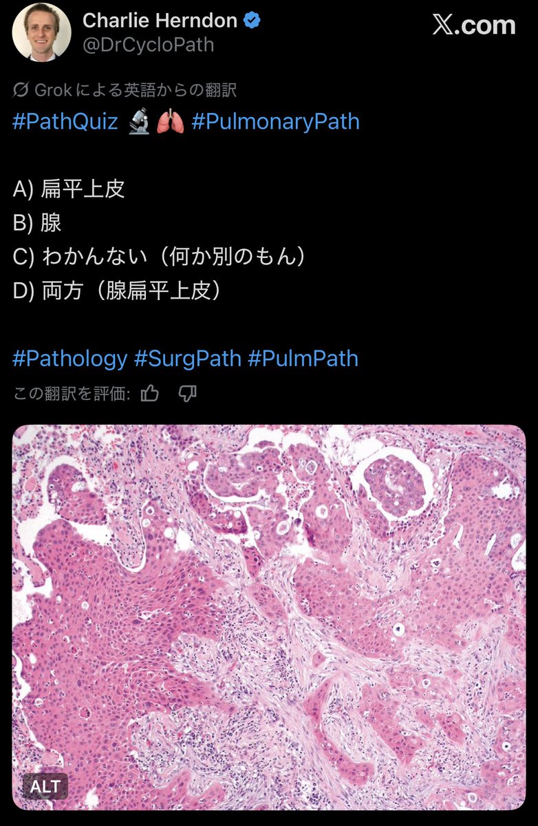 razhaPc's tweet photo. スクショして申し訳ないけど日本語訳www https://t.co/7CkuLkWH9l