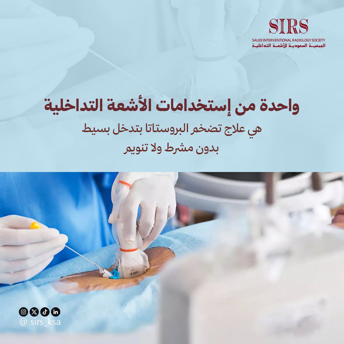 Saudi Interventional Radiology Society tweet media