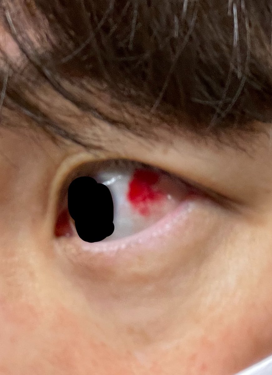 キク。BigBen831 tweet media