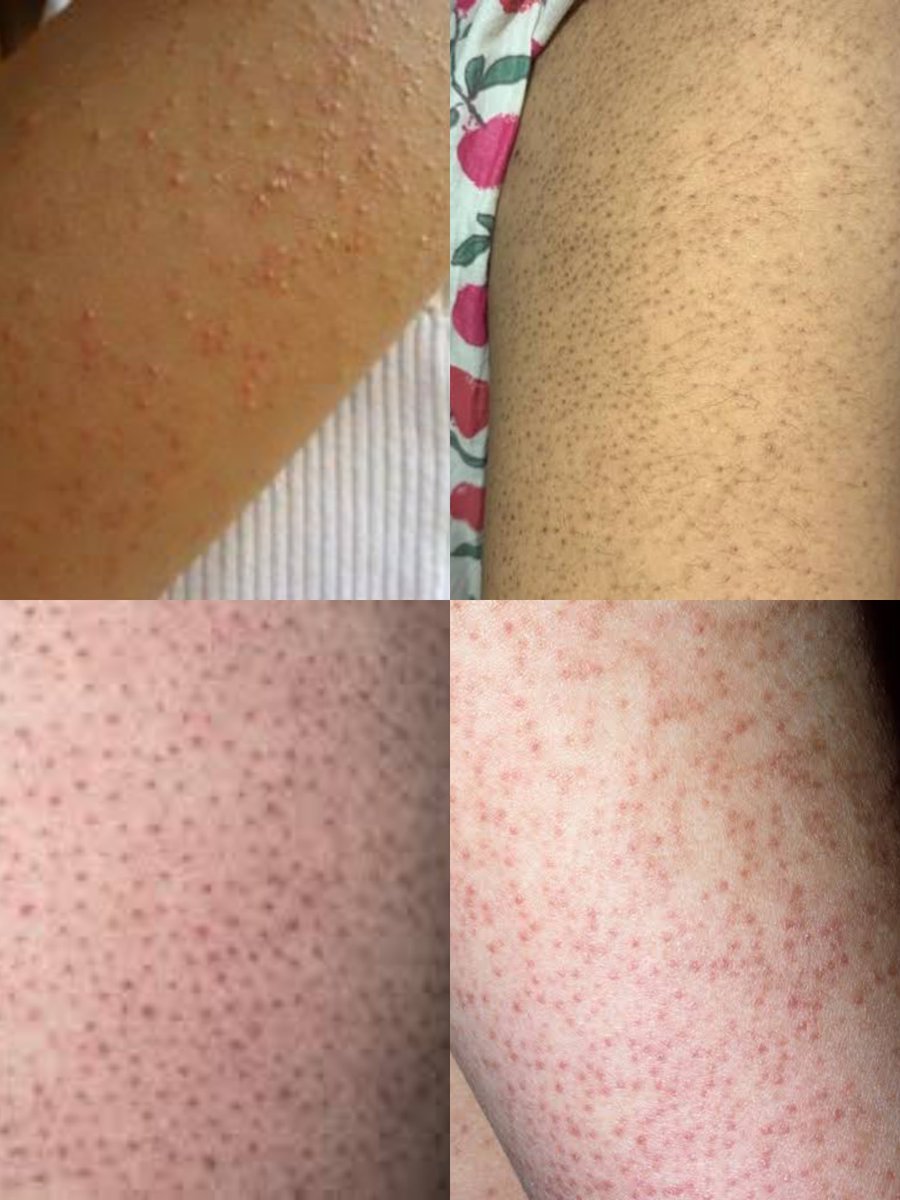 The_Mobile_Pharmacist👨⚕️💊⛑ tweet media