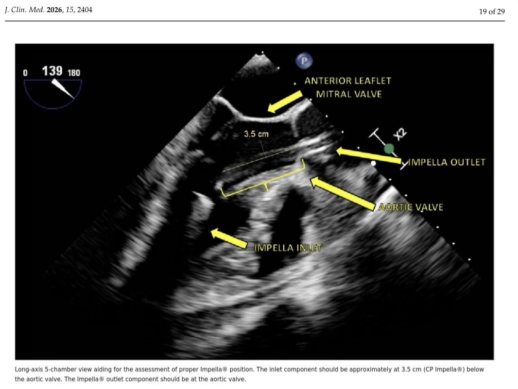Serginho1409's tweet image. Review
Echocardiographic Assessment Before, During, and After
Impella Positioning: State of the Art doi.org/10.3390/jcm150… #echofirst #MedEd #Cardiology #Echofirst #Pocus