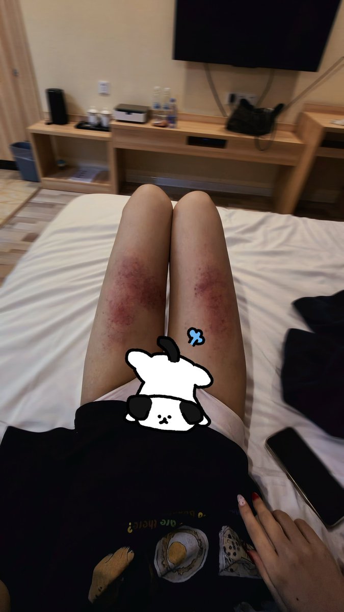 aixujinxi23814's tweet image. “知道自己有多虚了吗，才打这么会儿就紫了”#sp #男主女贝 #spank #调教 #小圈 
🐽：@zhaoazhaoa