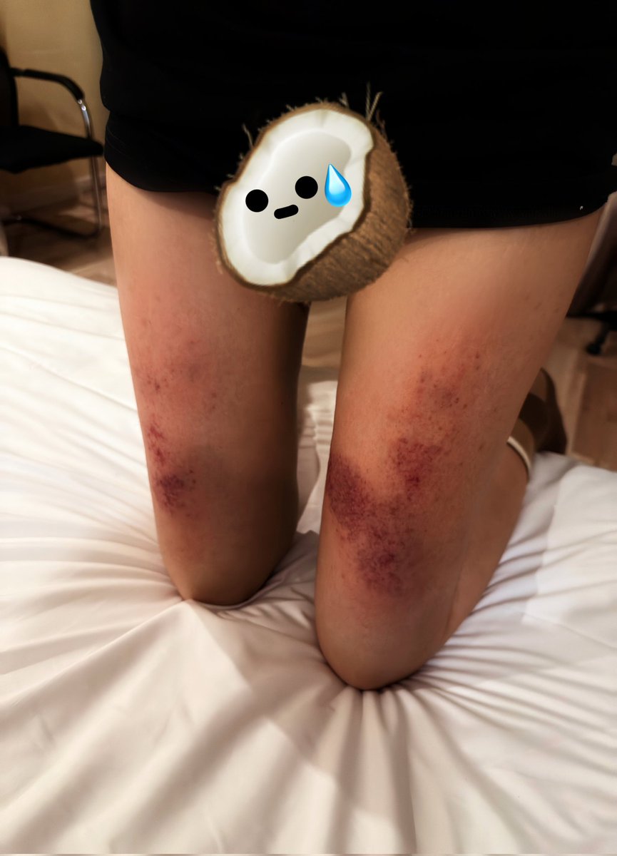 aixujinxi23814's tweet image. “知道自己有多虚了吗，才打这么会儿就紫了”#sp #男主女贝 #spank #调教 #小圈 
🐽：@zhaoazhaoa