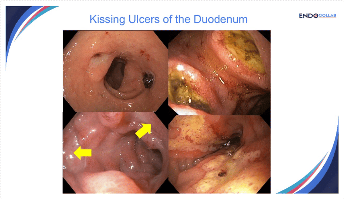 The Practicing Endoscopist tweet media