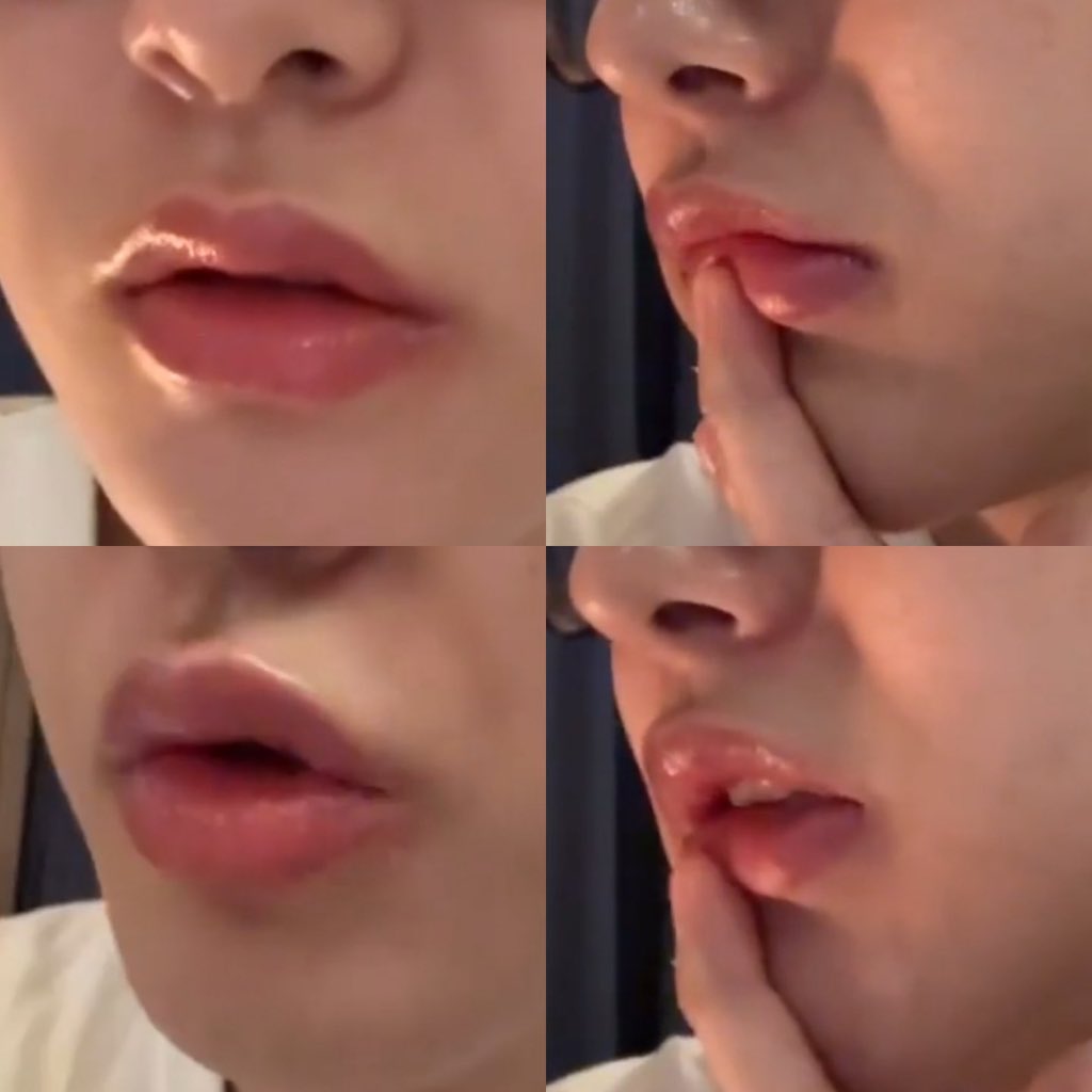 말랑순소 tweet media