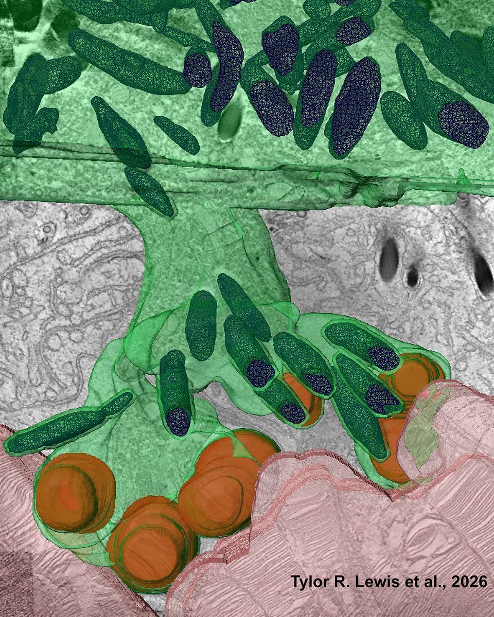 jclinicalinvest's tweet image. Retinal pigment epithelium pseudopods reach across the divide to maintain #photoreceptor performance and save #vision: doi.org/10.1172/JCI205…
 
Akrit Sodhi provides an Editor’s Note on Lewis et al.: doi.org/10.1172/JCI196… 
 
The image shown is an artistic rendering of a 3D