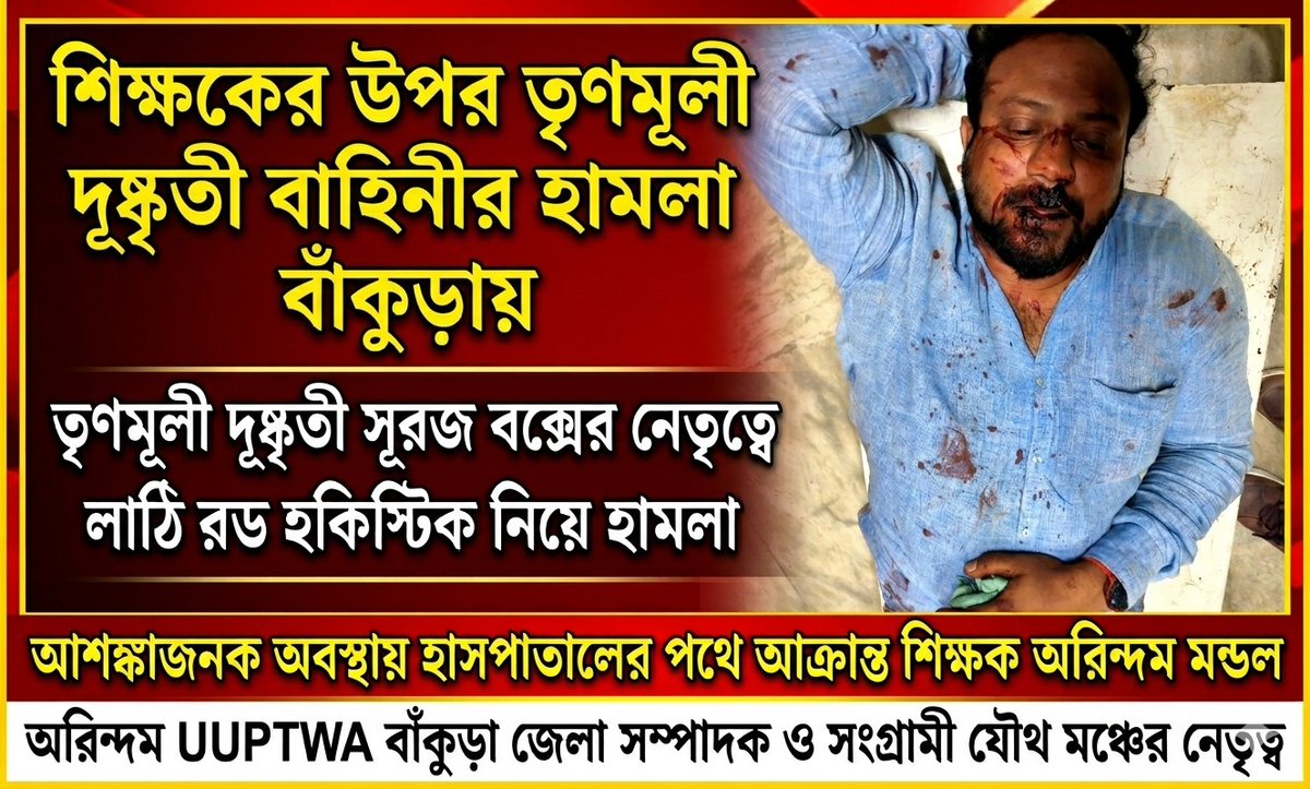 SushilKumar645's tweet photo. Targeted political violence in Bengal cannot be ignored.

SJM meeting aftermath in Bankura turns violent—Arindam Mondal attacked brutally.

@AmitShah @SuvenduWB @ANI @ABPNews @ECISVEEP

#BengalViolence #SaveDemocracy https://t.co/df0e26O6fs