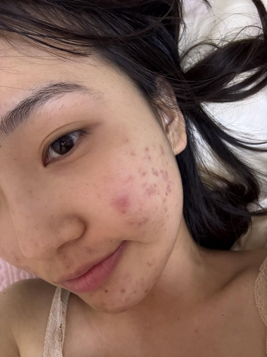 草莓蛋糕 tweet media