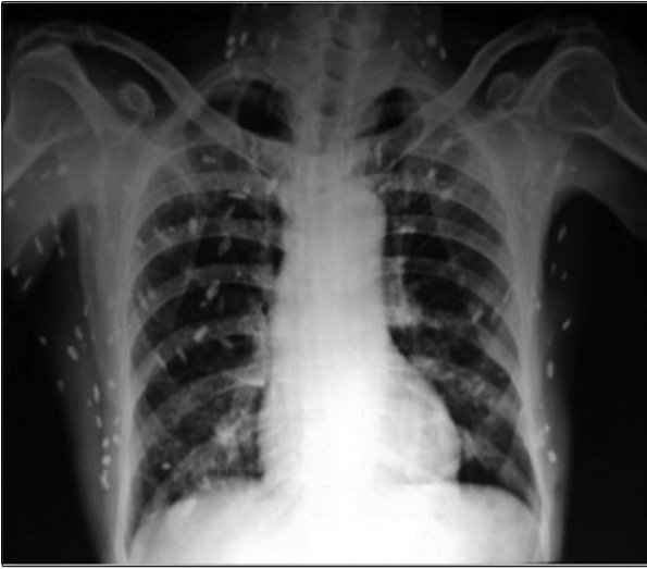 Jesus Osorio tweet media