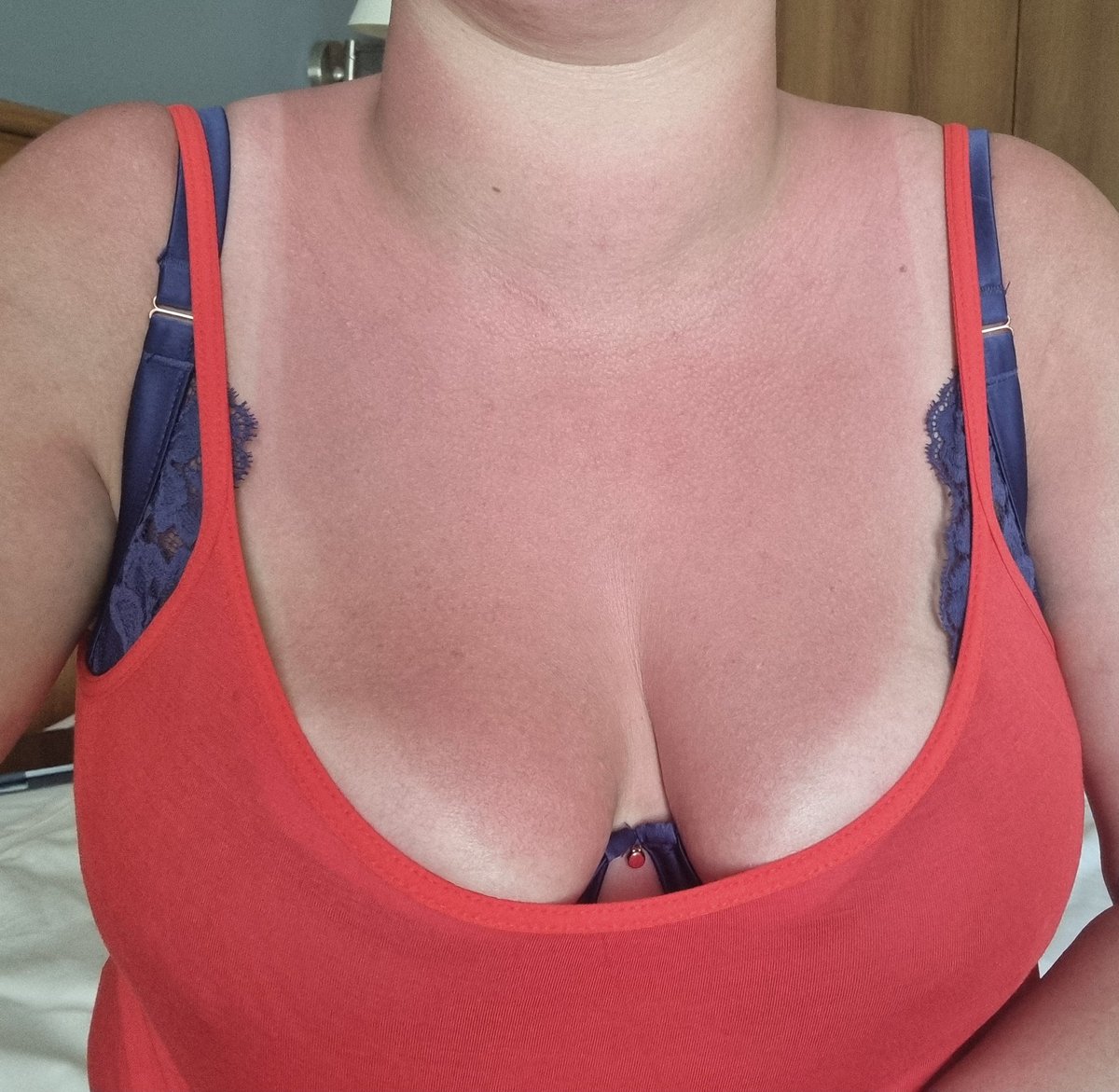 SlutforB's tweet photo. On holiday in turkey and i'm a little bit sunburnt, need someone to rub some aftersun cream onto my skin https://t.co/4Y40WdRPt9