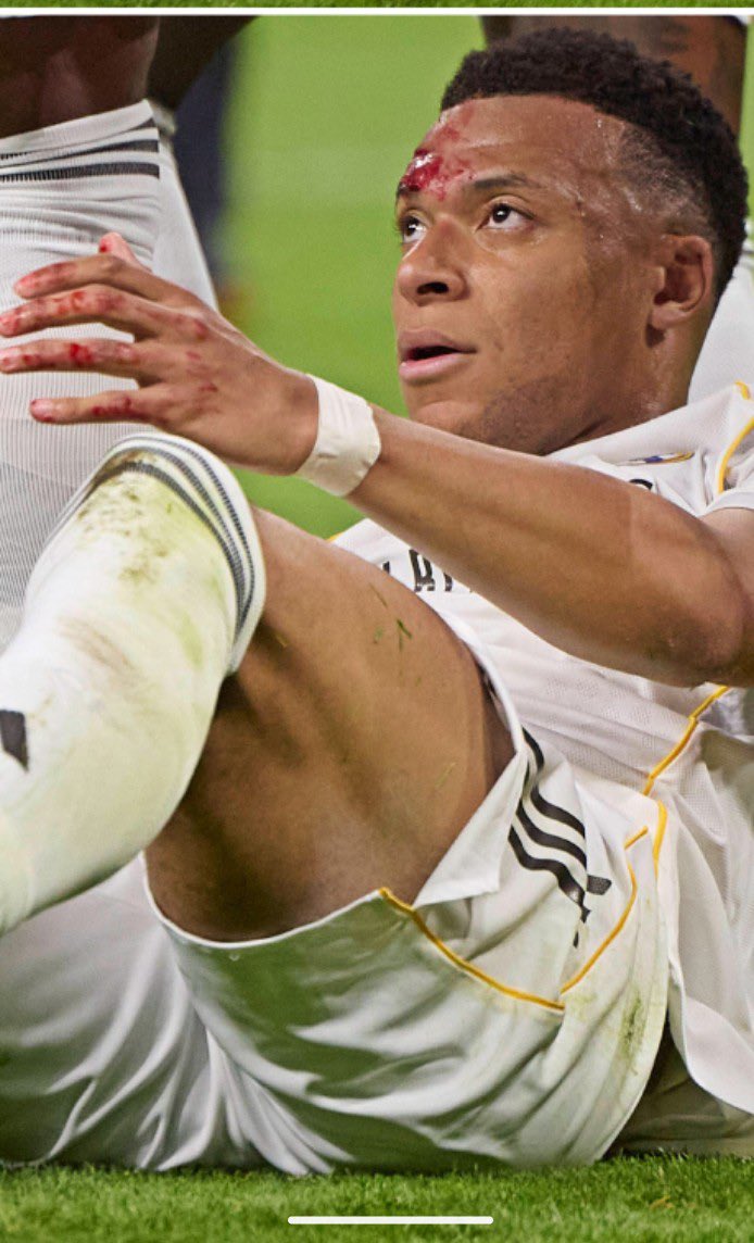 MasBucosNo tweet media