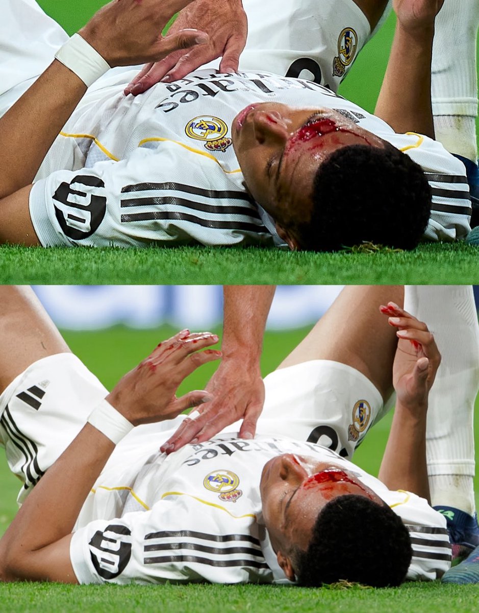 efooball5089's tweet photo. Real Madrid’s Mbappe is injured 😭💔🙏 https://t.co/TchxUbmxUI