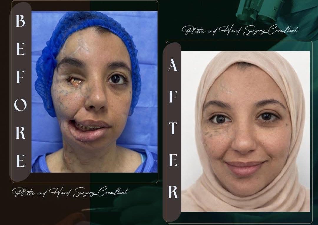 Mahmud PS 🇵🇸 tweet media