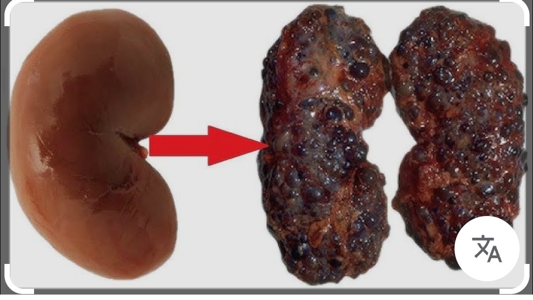 Recep Somuncu tweet media