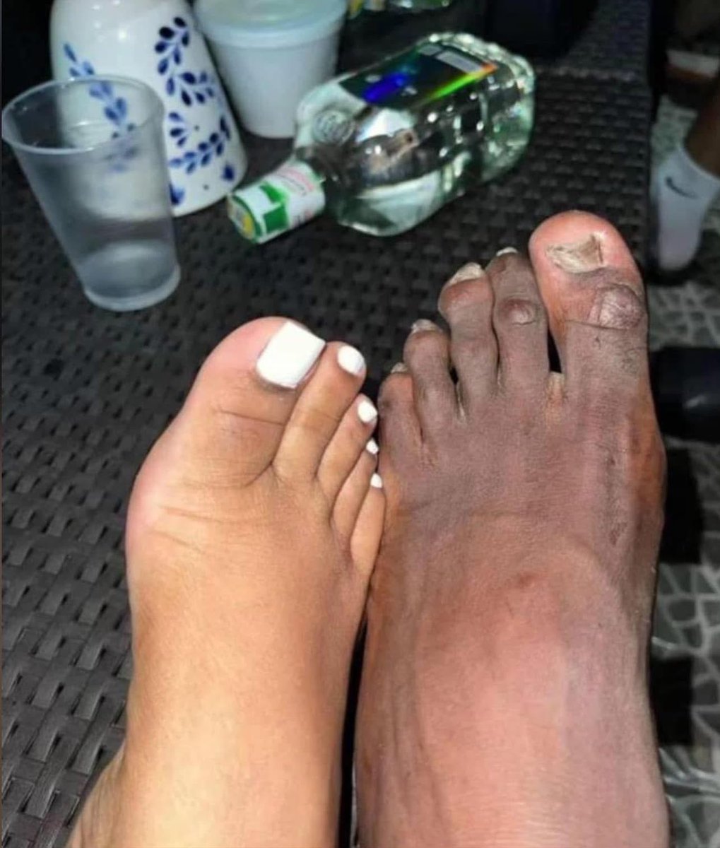 Chubby Audrey🍼 tweet media