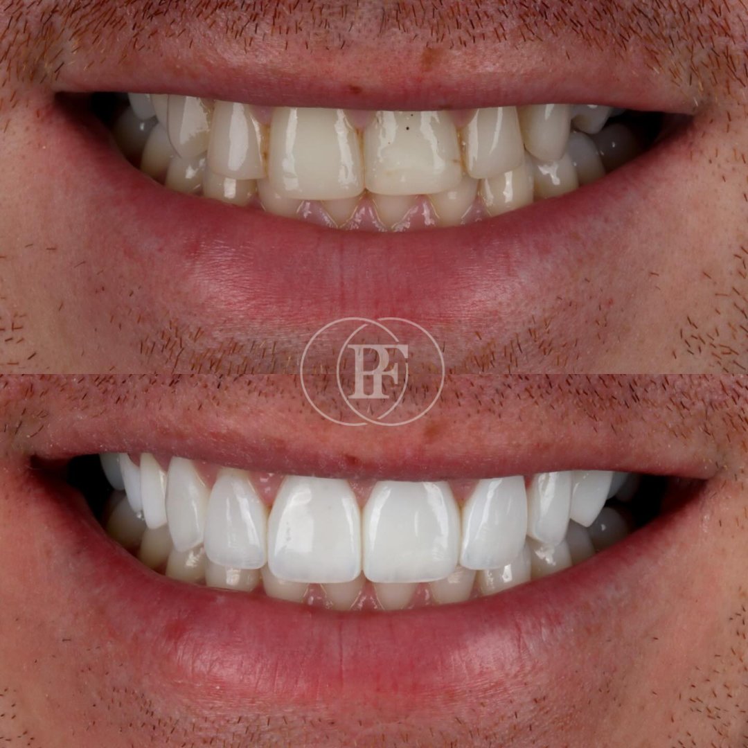 Pain Free Dentistry Group tweet media