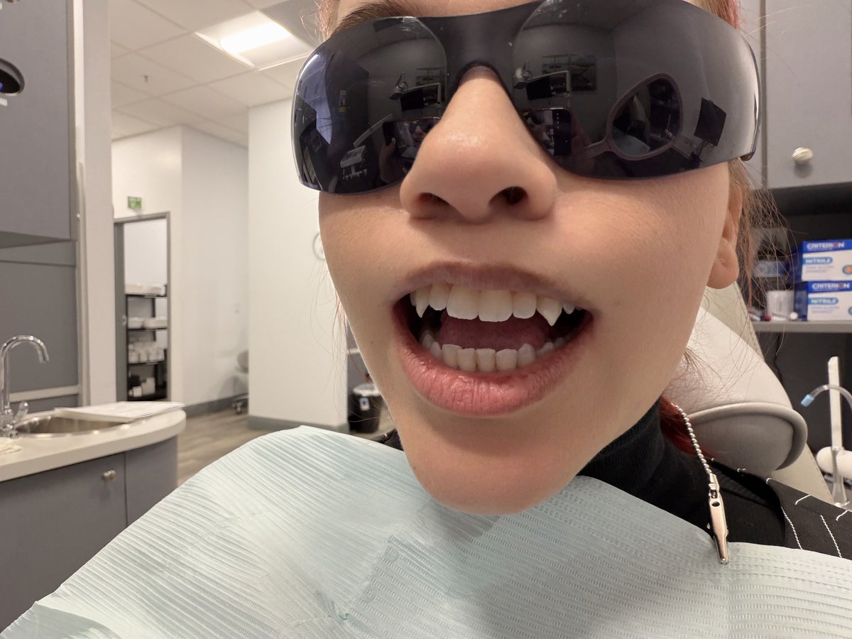 NPC_Chick's tweet image. Got my teeth done! 🙌🏼 
I got permanent fangs over in St. Cloud at Sage Dental! 🦷 #vampire #teeth