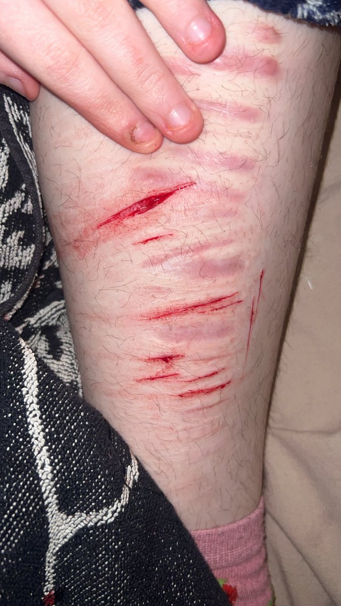 i hate how hairy my leg is 🙁