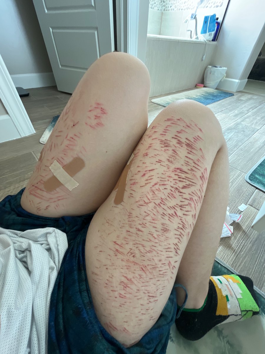 Dum pup of #shedtwt tweet media