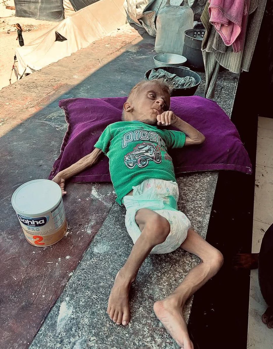 مشهد يدمي القلب 💔
افتحوا معابر من اجل هؤلاء الاطفال ياولاد وسخة