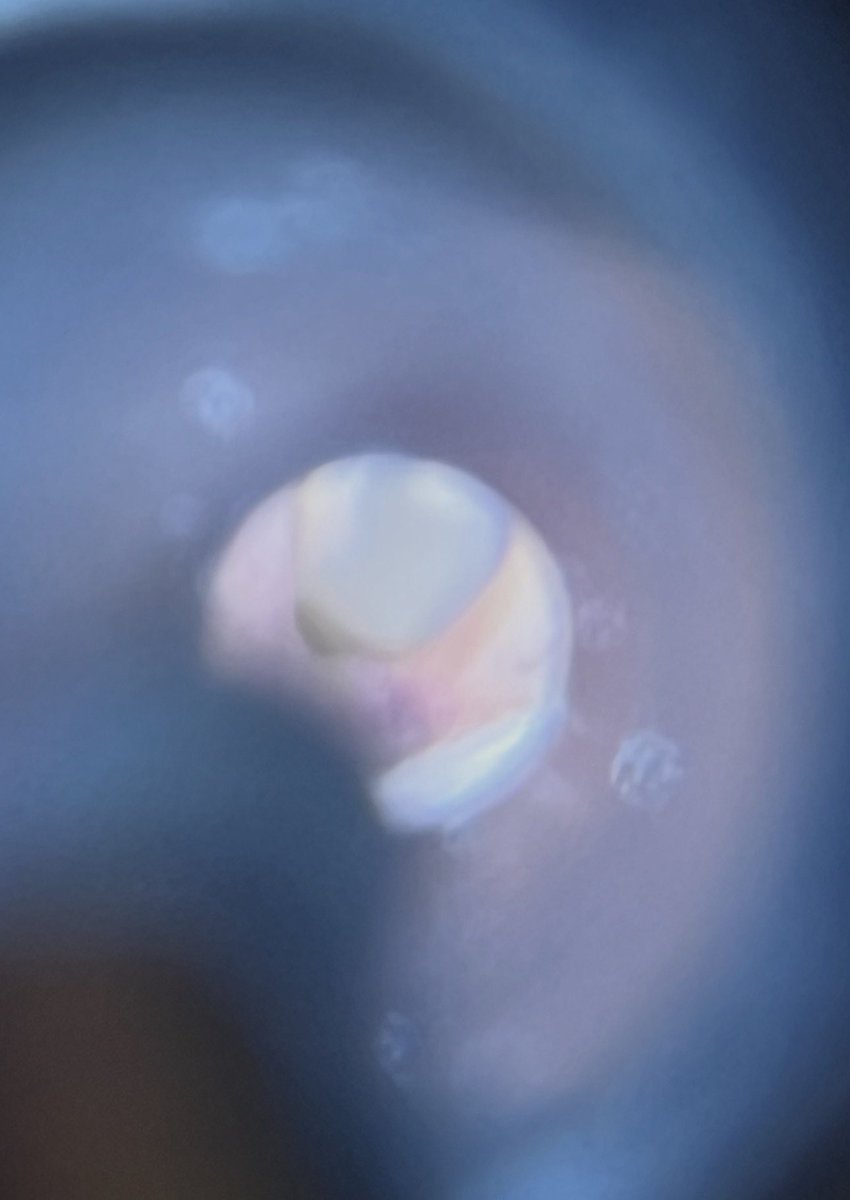 B, The Favorite Ex-GF ✨ tweet media